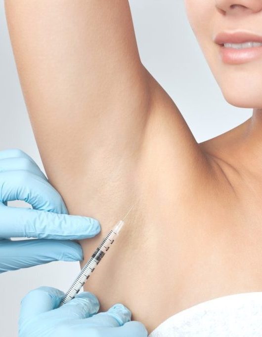 بوتاکس زیر بغل