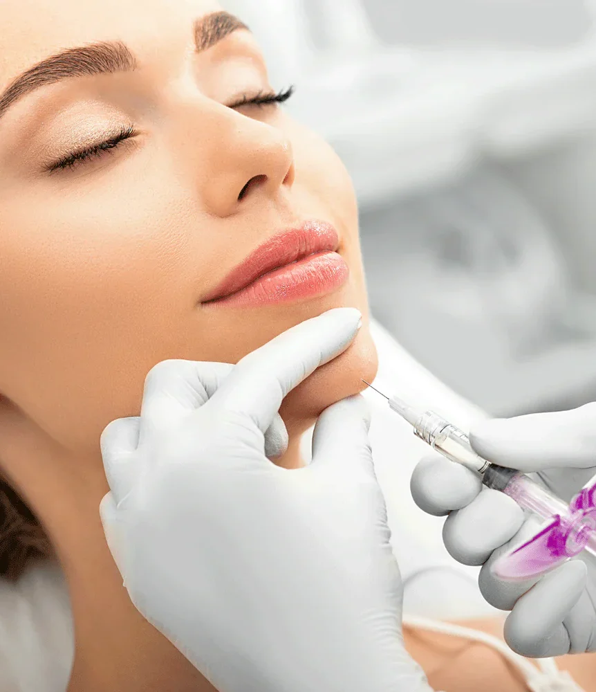 فیلر زاویه فک و چانه